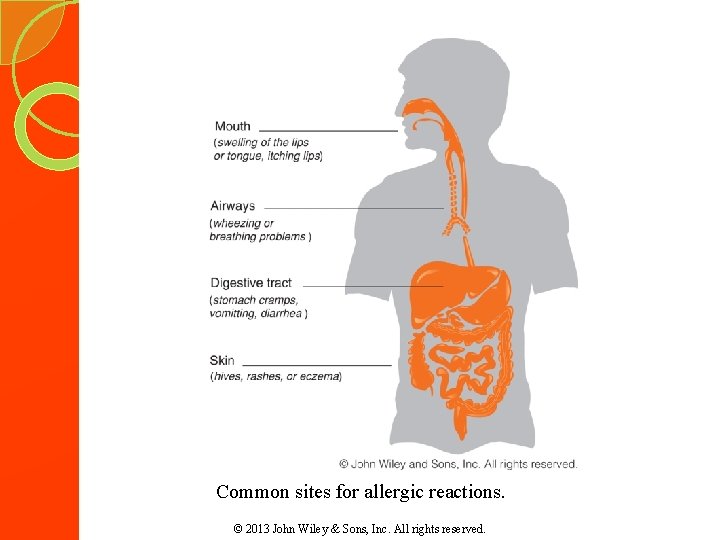 Common sites for allergic reactions. © 2013 John Wiley & Sons, Inc. All rights