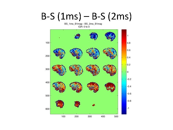 B-S (1 ms) – B-S (2 ms) 