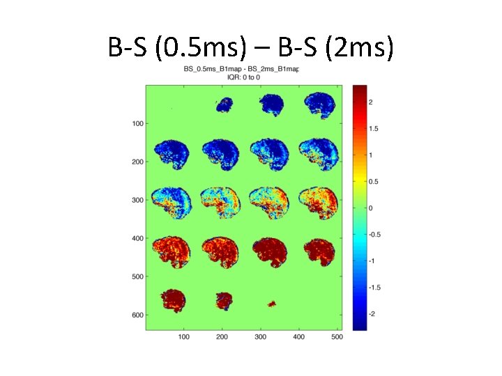 B-S (0. 5 ms) – B-S (2 ms) 