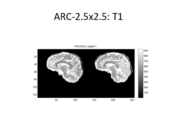 ARC-2. 5 x 2. 5: T 1 