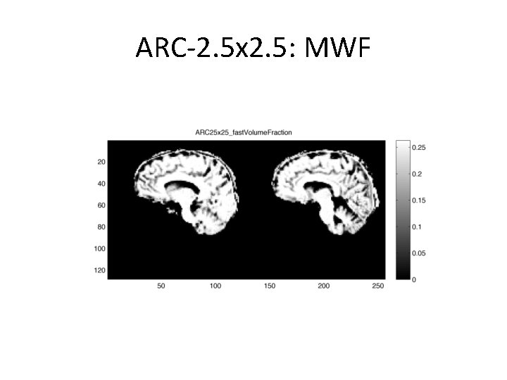 ARC-2. 5 x 2. 5: MWF 