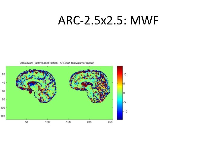 ARC-2. 5 x 2. 5: MWF 