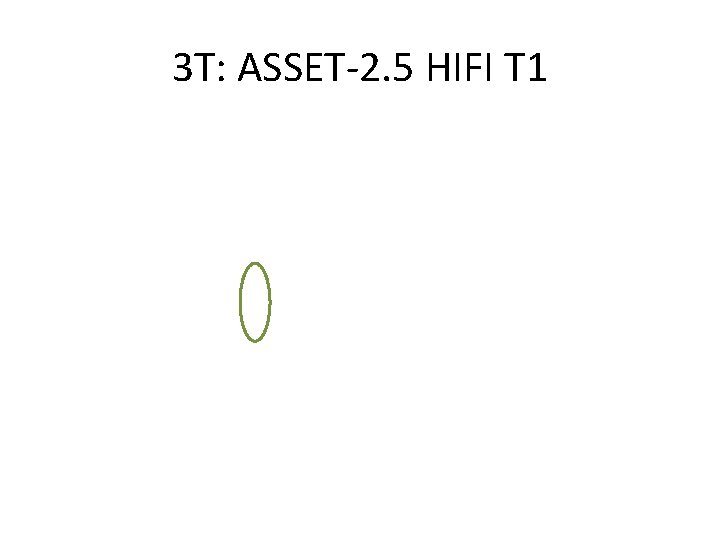 3 T: ASSET-2. 5 HIFI T 1 