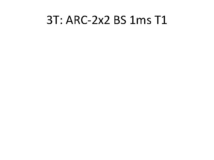 3 T: ARC-2 x 2 BS 1 ms T 1 