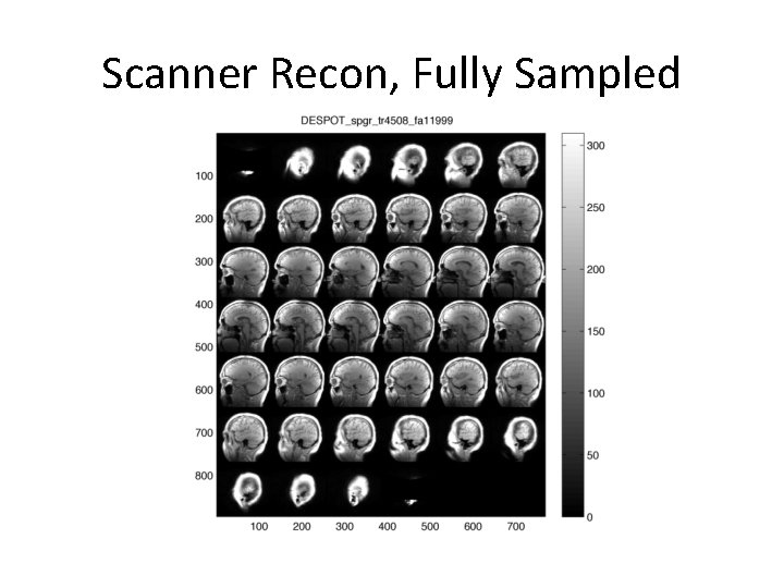 Scanner Recon, Fully Sampled 