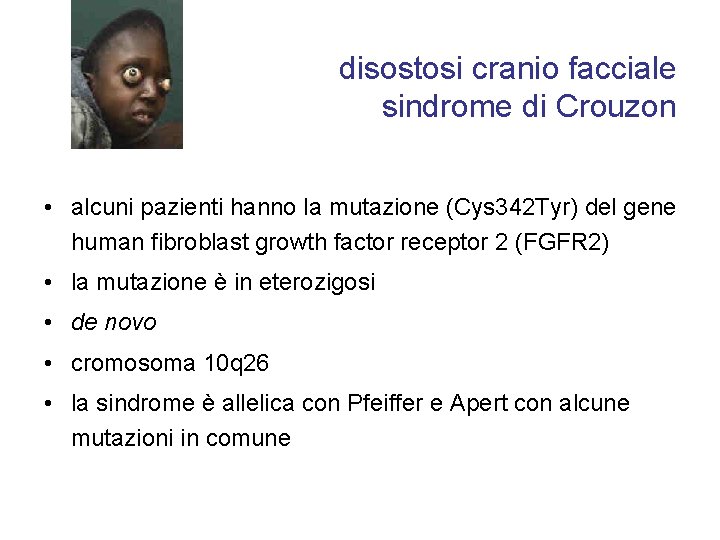 disostosi cranio facciale sindrome di Crouzon • alcuni pazienti hanno la mutazione (Cys 342