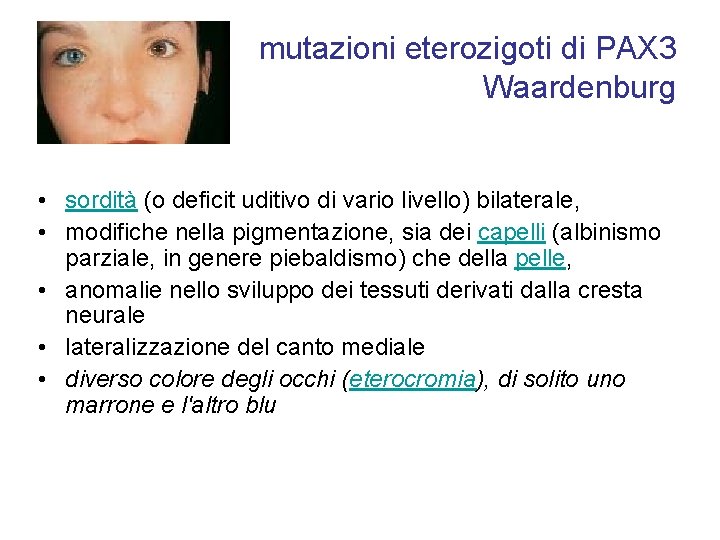 mutazioni eterozigoti di PAX 3 Waardenburg • sordità (o deficit uditivo di vario livello)