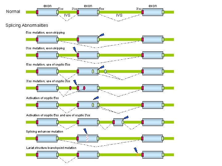 exon Normal 5’ss 3’ss exon IVS Splicing Abnormalities 5’ss mutation; exon skipping 3’ss mutation;