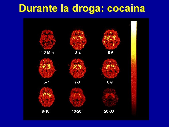 Durante la droga: cocaina 1 -2 Min 3 -4 5 -6 6 -7 7