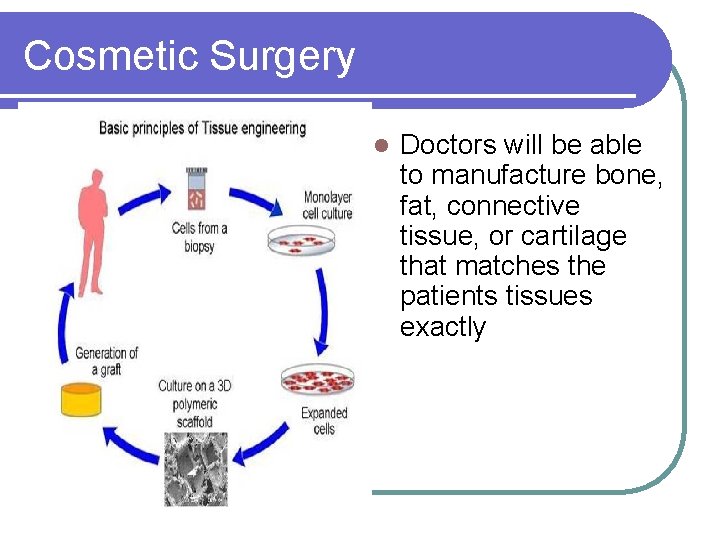 Cosmetic Surgery l Doctors will be able to manufacture bone, fat, connective tissue, or