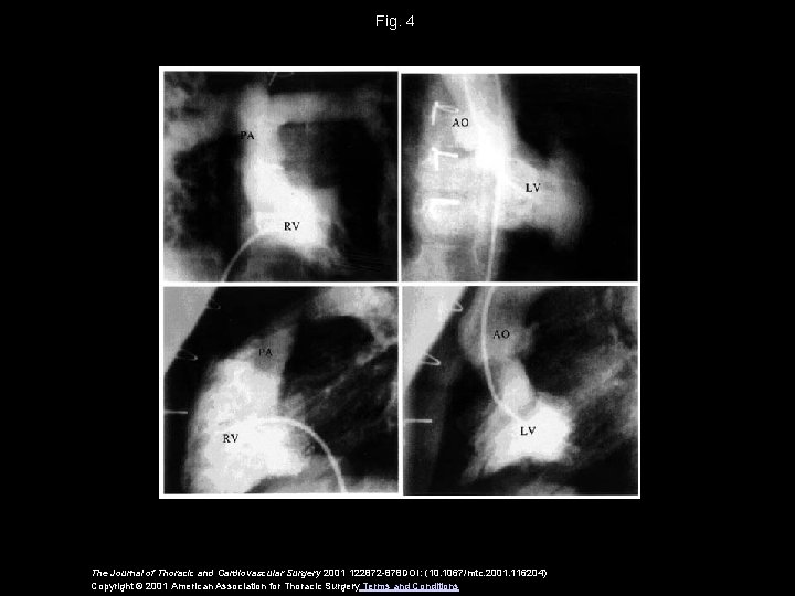 Fig. 4 The Journal of Thoracic and Cardiovascular Surgery 2001 122872 -878 DOI: (10.