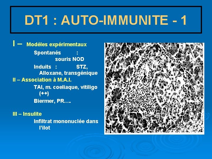 DT 1 : AUTO-IMMUNITE - 1 I – Modèles expérimentaux Spontanés : souris NOD