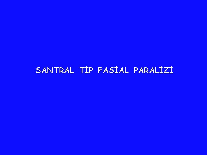 SANTRAL TİP FASİAL PARALİZİ SANTRAL TİP FASİAL PARALİZİ