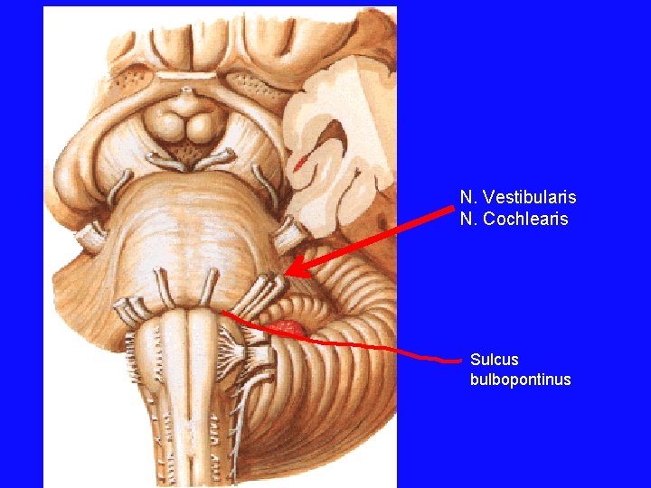 N. Vestibularis N. Cochlearis Sulcus bulbopontinus 