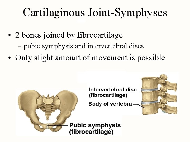 Cartilaginous Joint-Symphyses • 2 bones joined by fibrocartilage – pubic symphysis and intervertebral discs