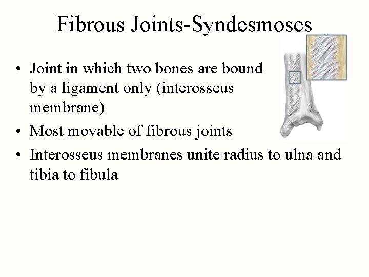 Fibrous Joints-Syndesmoses • Joint in which two bones are bound by a ligament only