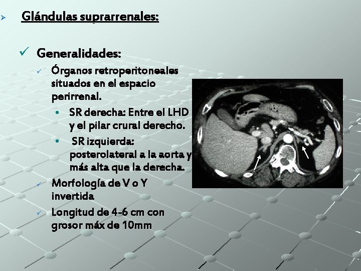 Ø Glándulas suprarrenales: ü Generalidades: ü ü ü Órganos retroperitoneales situados en el espacio