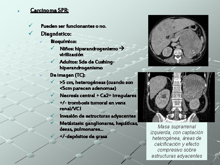 Ø Carcinoma SPR: ü Pueden ser funcionantes o no. ü Diagnóstico: ü ü Bioquímico: