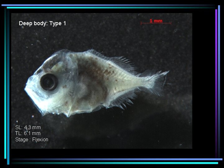 Deep body: Type 1 SL: 4. 3 mm TL: 6. 1 mm Stage :