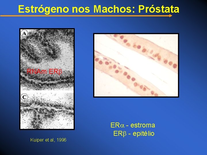 Estrógeno nos Machos: Próstata RNAm ER - estroma ER - epitélio Kuiper et al,