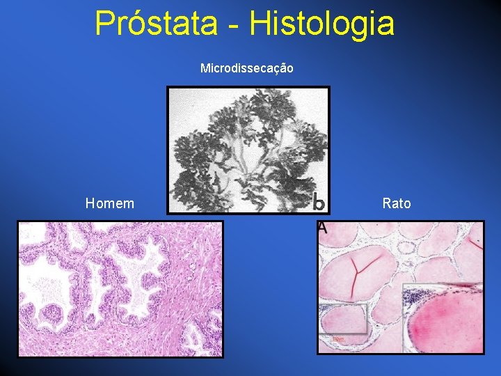 Próstata - Histologia Microdissecação Homem Rato 
