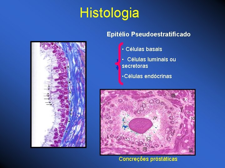Histologia Epitélio Pseudoestratificado • Células basais • Células luminais ou secretoras • Células endócrinas