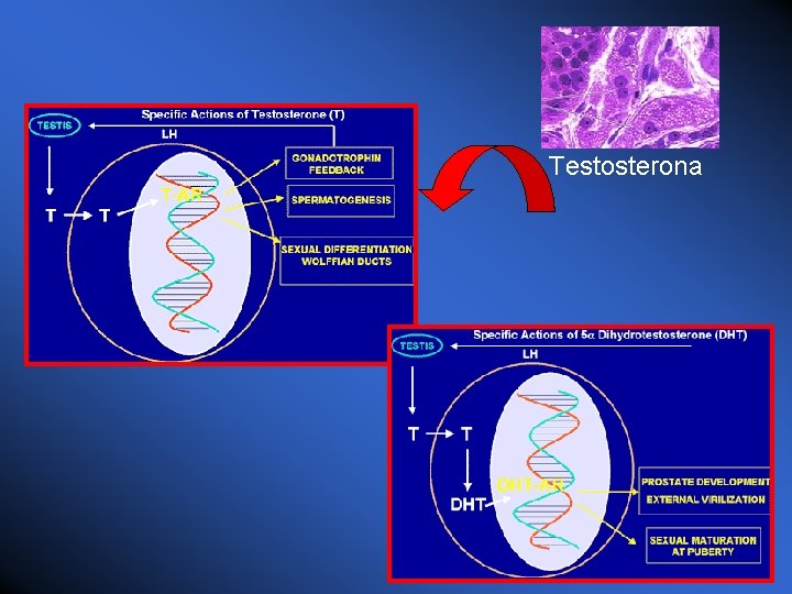 Testosterona 