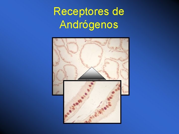 Receptores de Andrógenos 