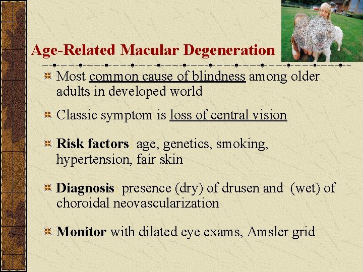 Age-Related Macular Degeneration Most common cause of blindness among older adults in developed world Age-Related Macular Degeneration Most common cause of blindness among older adults in developed world
