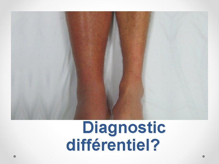 Diagnostic différentiel? 