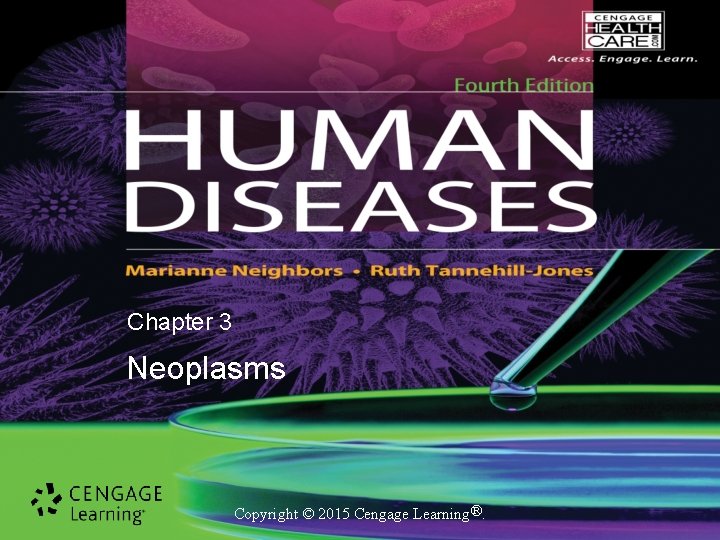 Chapter 3 Neoplasms Copyright © 2015 Cengage Learning®. 