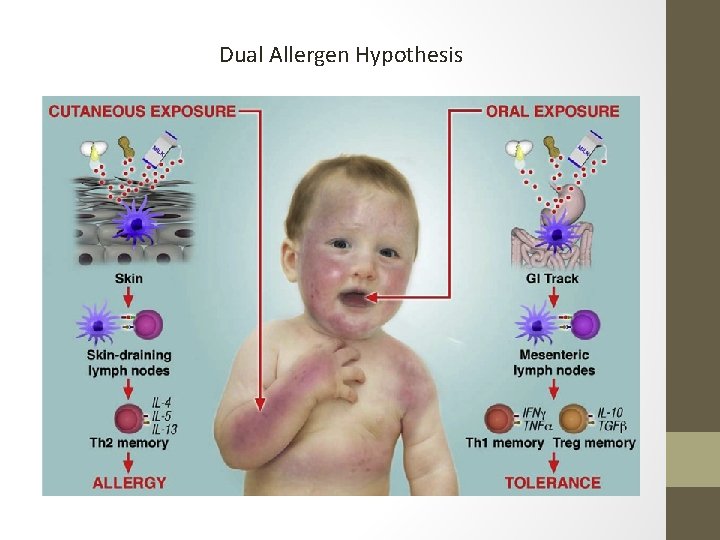 Dual Allergen Hypothesis 