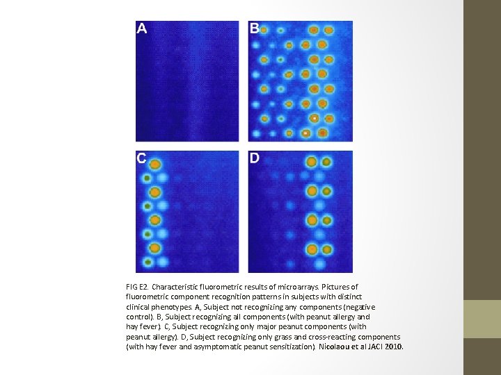 FIG E 2. Characteristic fluorometric results of microarrays. Pictures of fluorometric component recognition patterns
