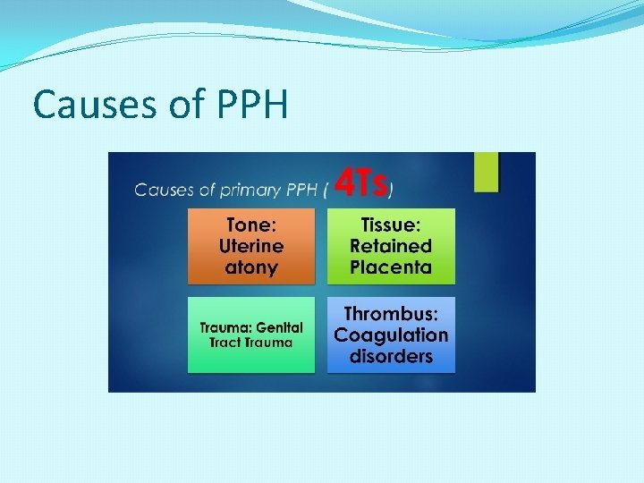 Causes of PPH 