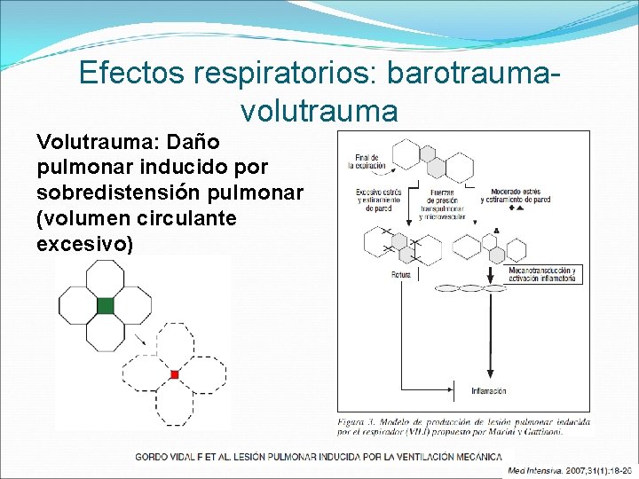 Efectos respiratorios: barotraumavolutrauma Volutrauma: Daño pulmonar inducido por sobredistensión pulmonar (volumen circulante excesivo) 