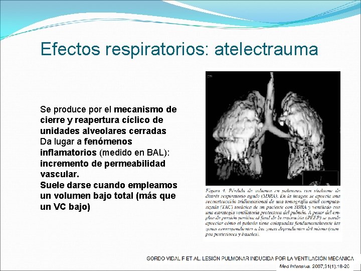 Efectos respiratorios: atelectrauma Se produce por el mecanismo de cierre y reapertura cíclico de