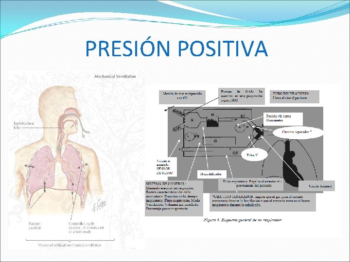 PRESIÓN POSITIVA 