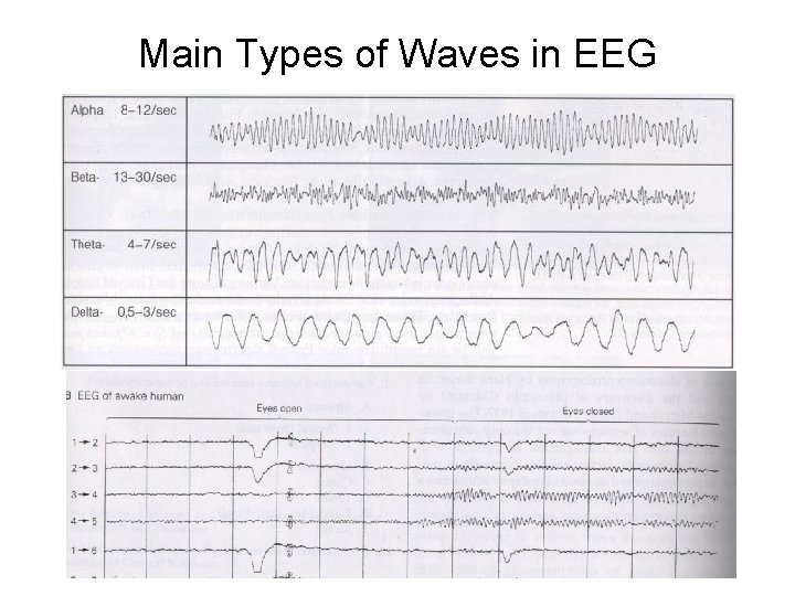 Main Types of Waves in EEG 