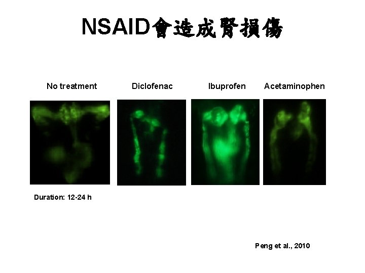NSAID會造成腎損傷 No treatment Diclofenac Ibuprofen Acetaminophen Duration: 12 -24 h Peng et al. , NSAID會造成腎損傷 No treatment Diclofenac Ibuprofen Acetaminophen Duration: 12 -24 h Peng et al. ,