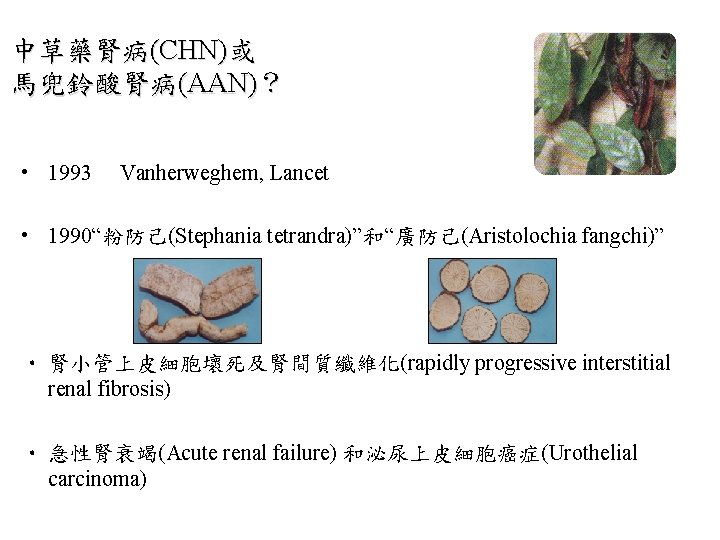 中草藥腎病(CHN)或 馬兜鈴酸腎病(AAN)? • 1993 Vanherweghem, Lancet • 1990“粉防己(Stephania tetrandra)”和“廣防己(Aristolochia fangchi)” • 腎小管上皮細胞壞死及腎間質纖維化(rapidly progressive interstitial 中草藥腎病(CHN)或 馬兜鈴酸腎病(AAN)? • 1993 Vanherweghem, Lancet • 1990“粉防己(Stephania tetrandra)”和“廣防己(Aristolochia fangchi)” • 腎小管上皮細胞壞死及腎間質纖維化(rapidly progressive interstitial