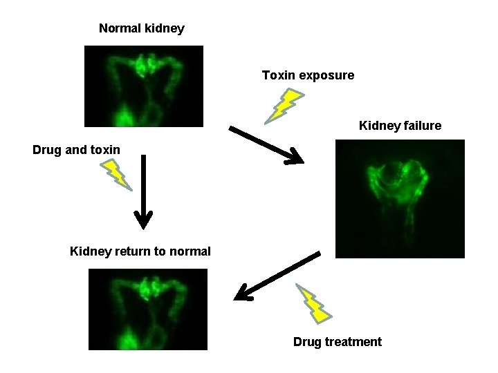 Normal kidney Toxin exposure Kidney failure Drug and toxin Kidney return to normal Drug Normal kidney Toxin exposure Kidney failure Drug and toxin Kidney return to normal Drug
