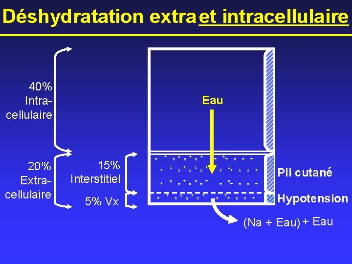 Déshydratation extra et intracellulaire 40% Intracellulaire 20% Extracellulaire Eau 15% Interstitiel 5% Vx *