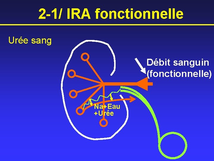 2 -1/ IRA fonctionnelle Urée sang Débit sanguin (fonctionnelle) Na+Eau +Urée 