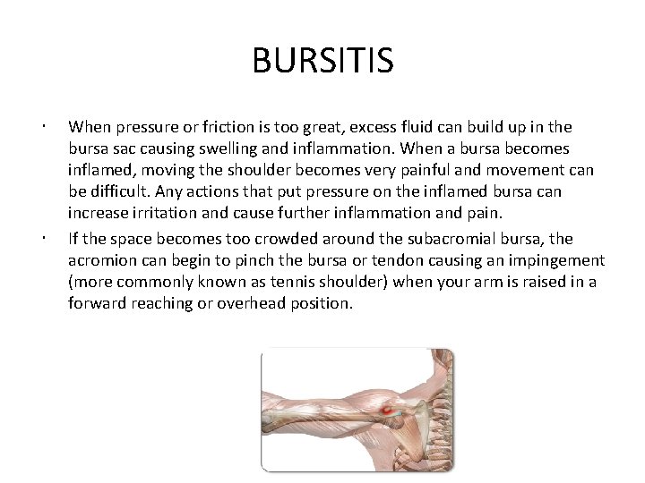 BURSITIS When pressure or friction is too great, excess fluid can build up in