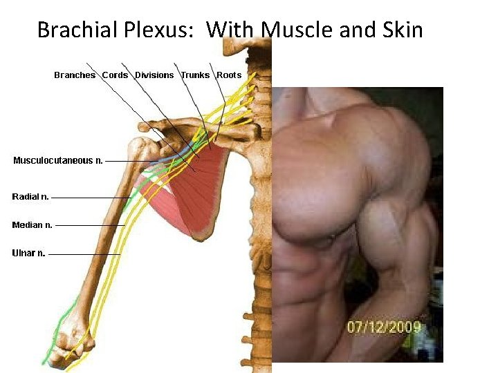 Brachial Plexus: With Muscle and Skin 