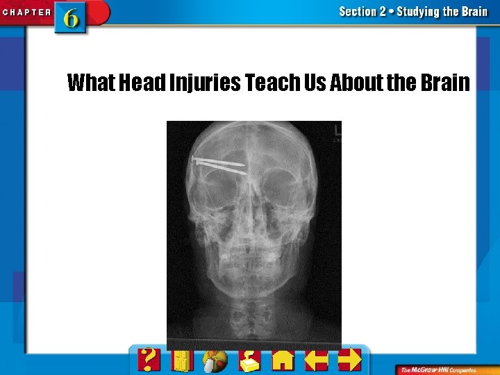 What Head Injuries Teach Us About the Brain 