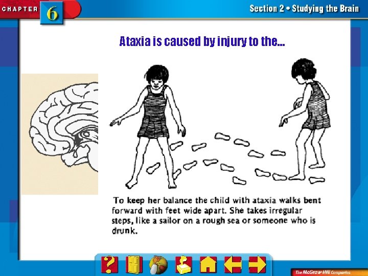 Ataxia is caused by injury to the… 