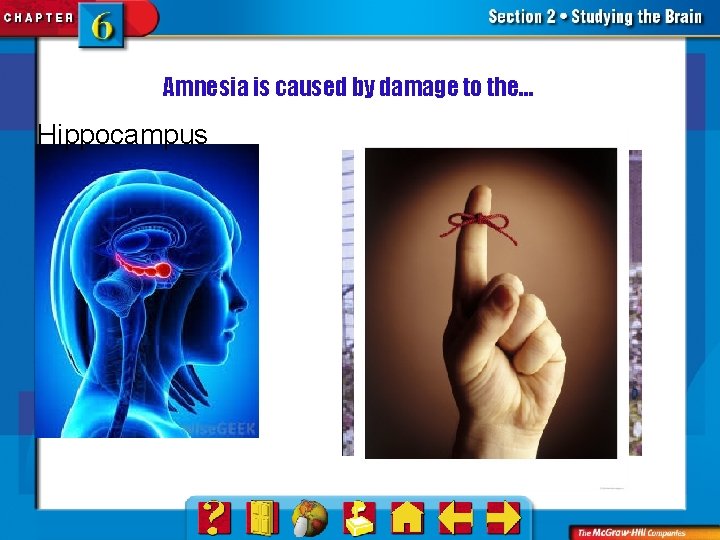 Amnesia is caused by damage to the… Hippocampus 