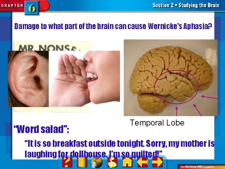 Damage to what part of the brain cause Wernicke’s Aphasia? “Word salad”: Temporal Lobe