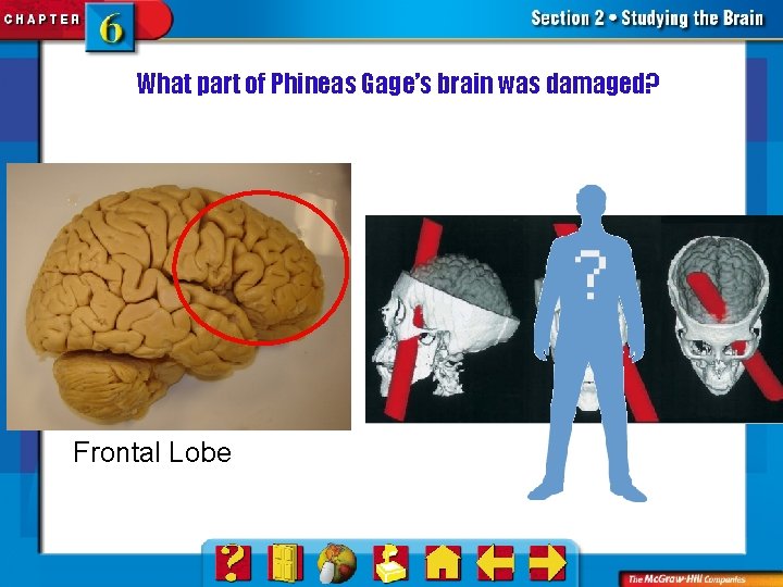 What part of Phineas Gage’s brain was damaged? Frontal Lobe 